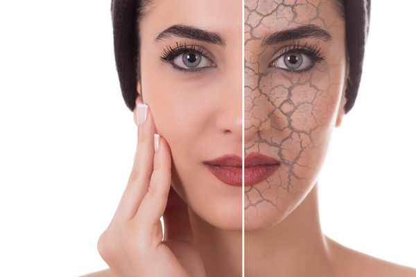 Dry Skin in Winters: How Charisma Cosmetics Can Help You Stay Hydrated and Glowing