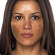 Dark Spots