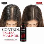 Oil Control Shampoo – Double Effector