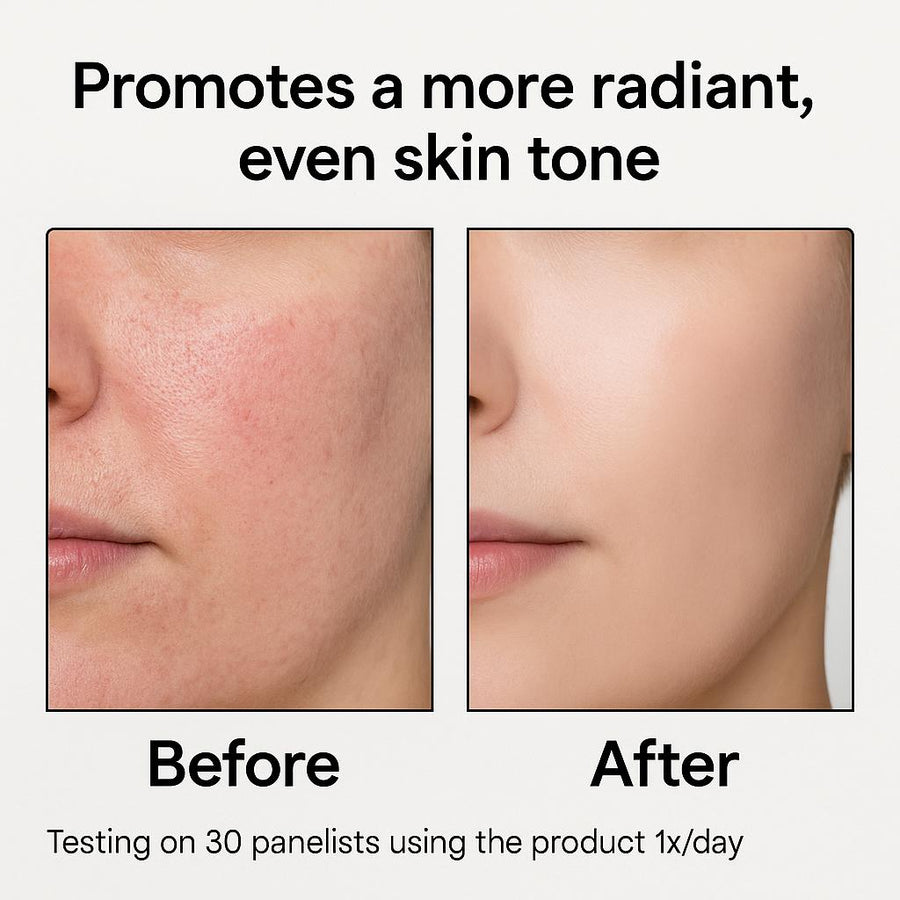 Glycolic Acid + Witch Hazel