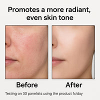 Glycolic Acid + Witch Hazel