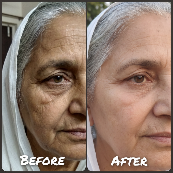 Anti-ageing before and after – fine lines and wrinkles softened with Charisma Anti-Ageing Repair Plan
