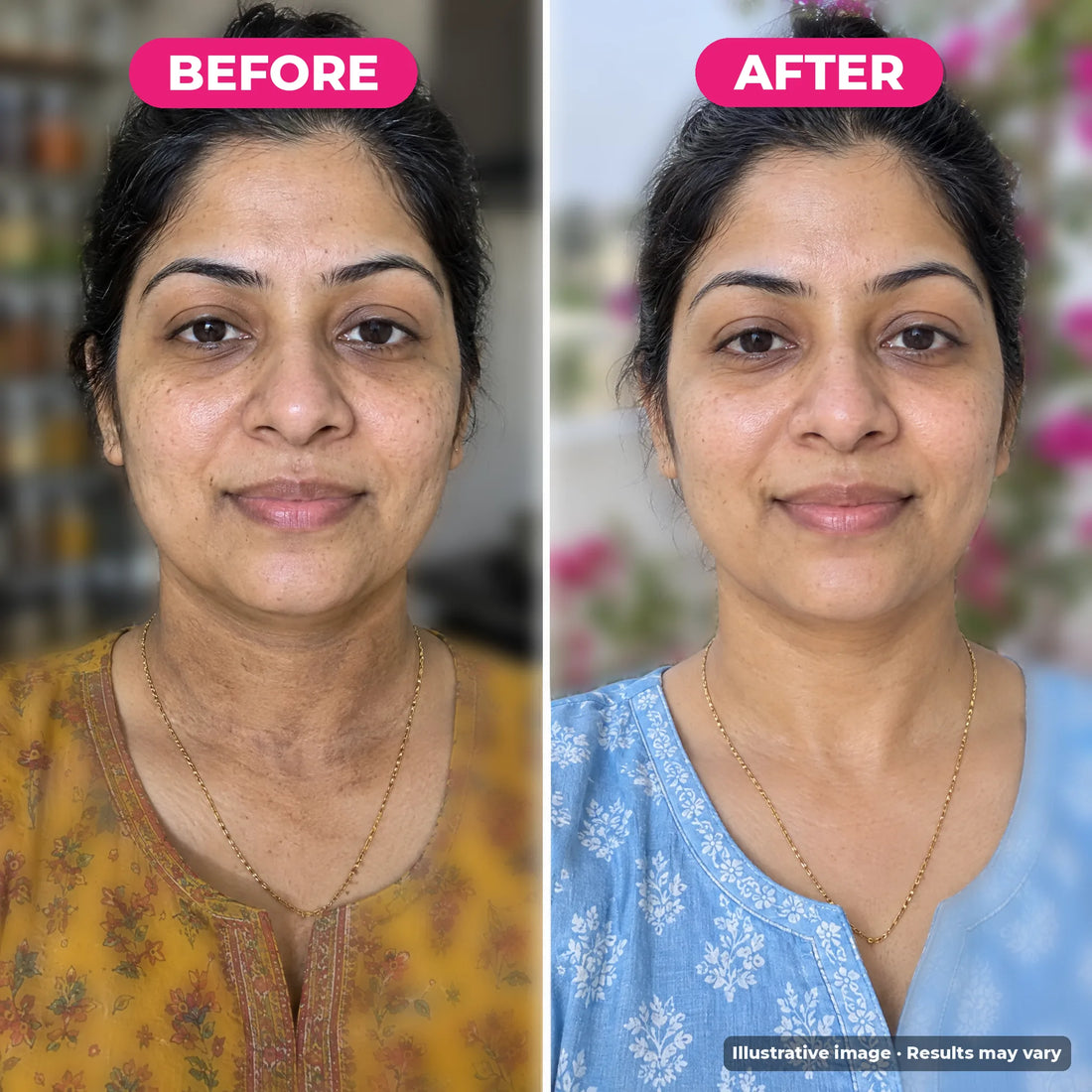 Face to Neck Glow Cream before and after: dull, patchy neck that doesn't match the face (before) and a more even, glowing face and neck (after). Illustrative image, results may vary.