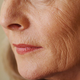 Anti-Aging